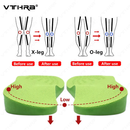 O/X-Leg Orthopedic Insoles